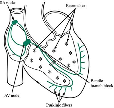 Detection of Life Threatening Ventricular Arrhythmia Using Digital Taylor Fourier Transform